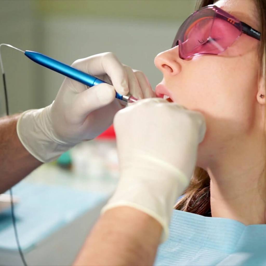 Centre Dentaire St. Laurent 3 Stages of Gum Disease