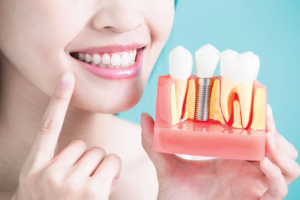 Our services Centre Dentaire St Laurent Saint-Laurent Dental Dentist